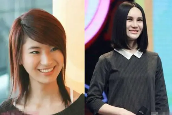 娱乐圈整容女明星名单_娱乐圈没整过容的明星_孙菲菲整容后无戏可拍